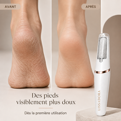 Râpe électrique - Beauté des pieds en 3 minutes